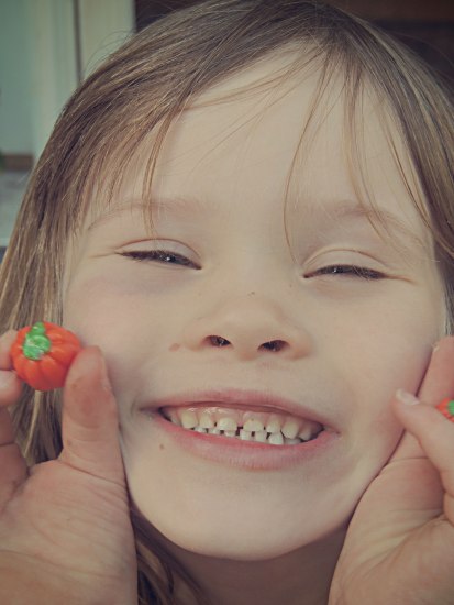 Clara with black eye